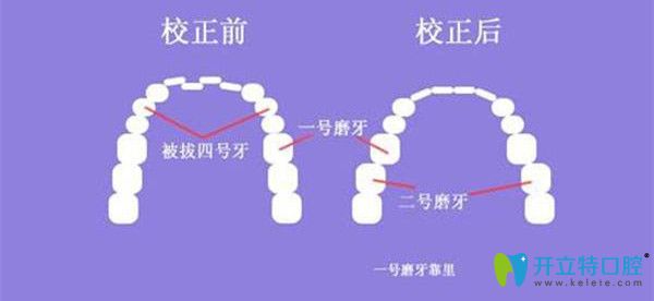 矯正前后的區(qū)別圖