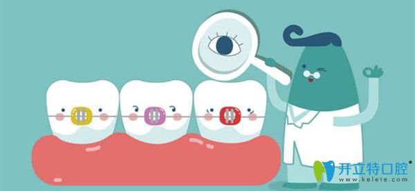 口腔正畸后多久復(fù)查呢