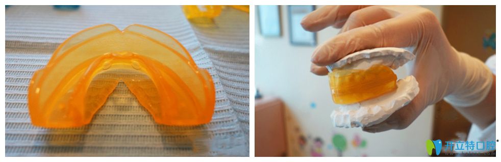 mrc兒童肌功能矯治器