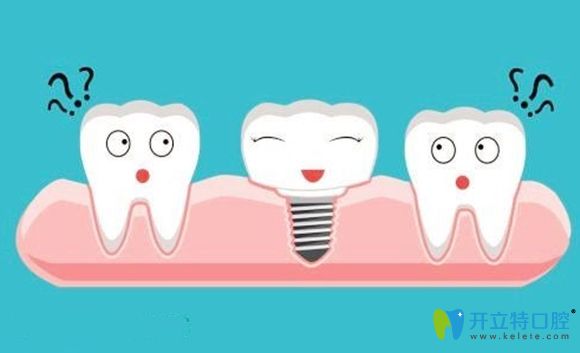 長(zhǎng)沙種植牙多少錢(qián)一顆呢