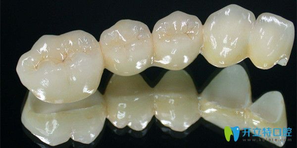 醫(yī)生為什么建議做二氧化鋯全瓷牙