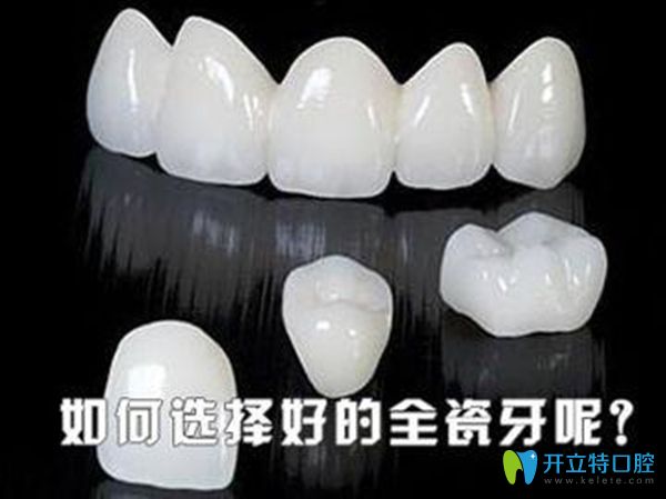 2025全瓷牙品牌排行榜及價(jià)格表-含威蘭德|愛爾創(chuàng)|澤康全瓷牙