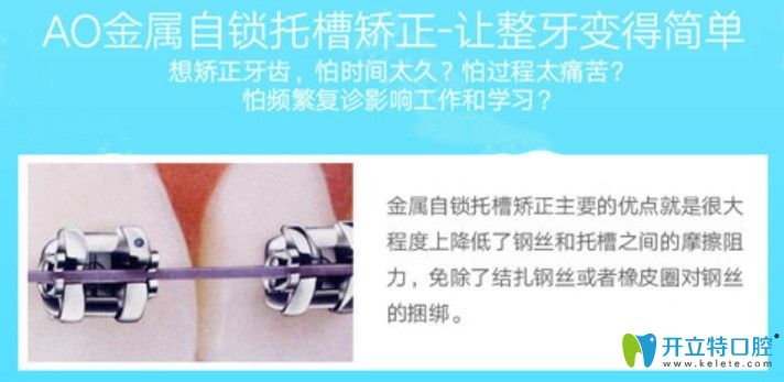 Ao自鎖托槽矯正優(yōu)勢(shì)
