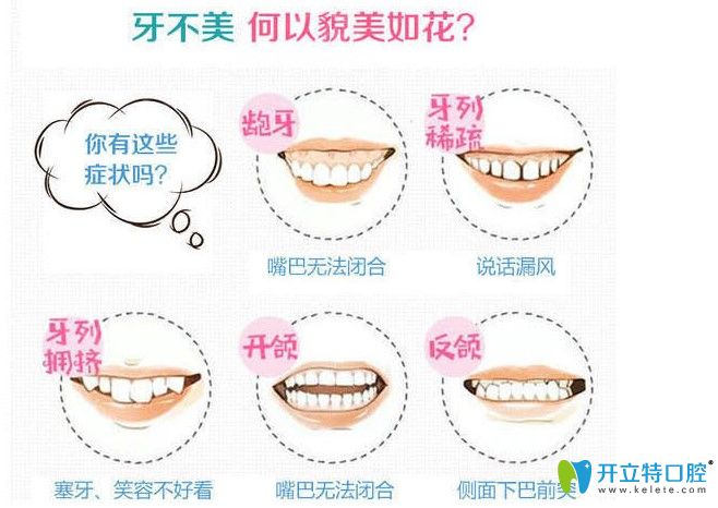 牙齒畸形趕緊趁著活動來銘德做正畸