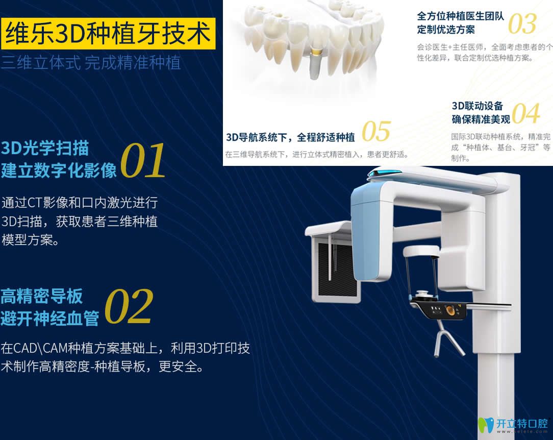 福州維樂(lè)口腔3D微創(chuàng)種植牙技術(shù)