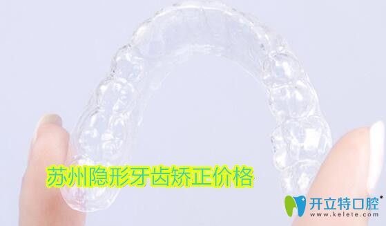 蘇州隱形牙齒矯正價(jià)格