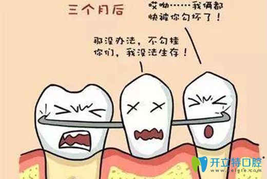 活動(dòng)義齒的修復(fù)原理圖