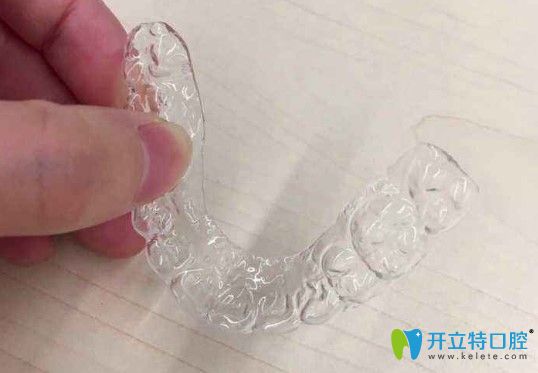 李瑛杰告訴你牙齒矯正后為什么會(huì)反彈