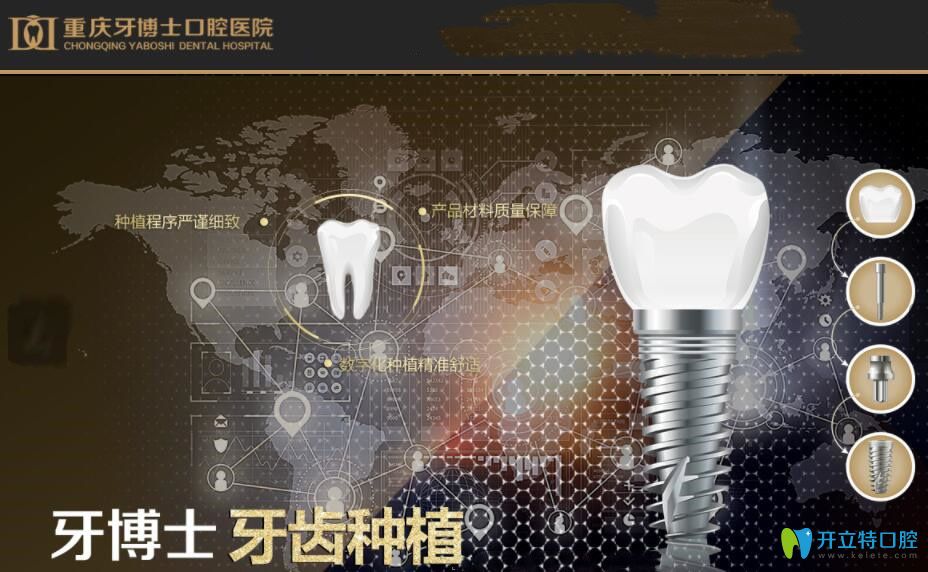 在重慶牙博士口腔微創(chuàng)種植牙后,談重慶種植牙價格6000元貴不