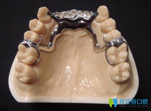 王躍來(lái)告訴大家老年人裝全口的活動(dòng)假牙選什么牌子的好