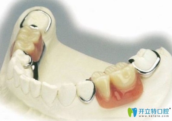 王銘智醫(yī)生來高度大家：年輕人適合安裝活動義齒嗎