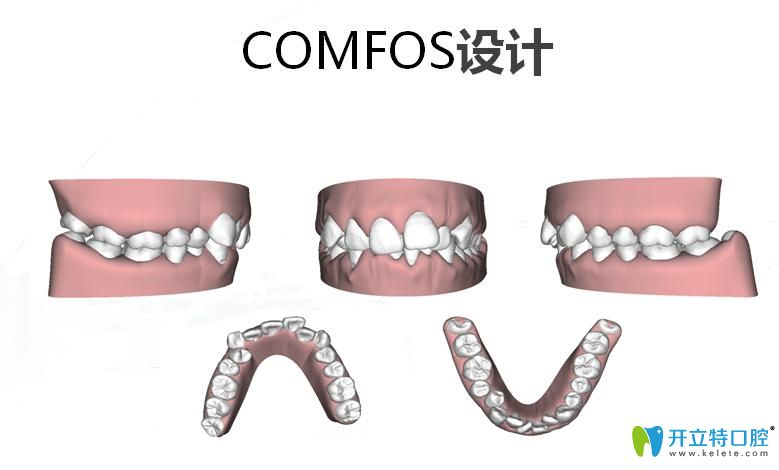 comfos設(shè)計(jì)圖示