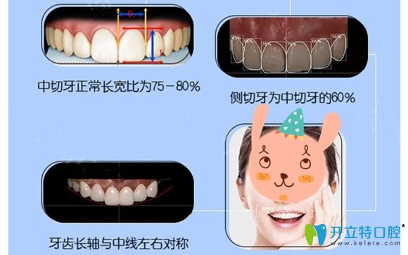 <!--<i data=20240703-sp></i>-->圣康口腔烤瓷牙修復(fù)特色圖