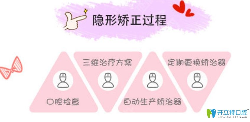 隱形矯正和鋼牙套哪個(gè)效果好