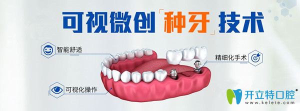 微創(chuàng)即刻種植牙 微創(chuàng)即刻種植牙