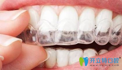 牙齒矯正 牙齒矯正