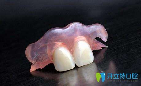 活動義齒的外觀 活動義齒的外觀