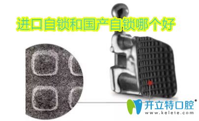 金屬自鎖托槽是國產(chǎn)還是進(jìn)口的好