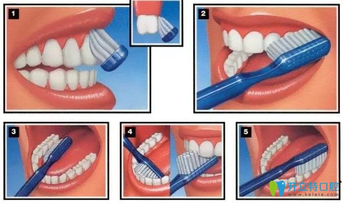 郝婷醫(yī)生告訴大家正確的刷牙方法 郝婷醫(yī)生告訴大家正確的刷牙方法