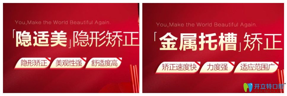 寧波藝星口腔矯正牙齒好劃算，隱適美隱形矯正價(jià)格才2.9萬(wàn)
