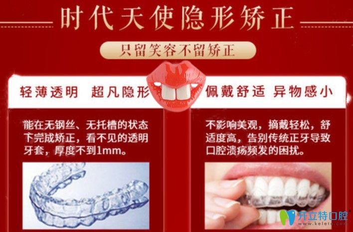 寧波藝星口腔時代天使牙套價格