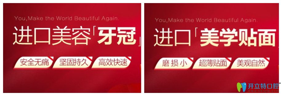 寧波藝星口腔進口牙齒貼面價格