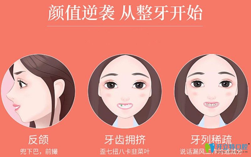 牙醫(yī)深度解析：自鎖托槽有幾種牌子？自鎖牙套3m好還是damon