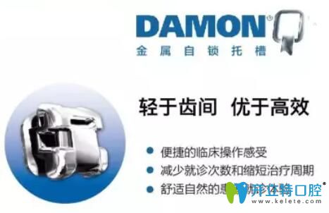 美國damon矯正器價格怎么樣,先清楚與3m的區(qū)別及和ormco哪個好