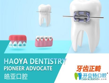 蘭州牙齒矯正哪里價(jià)格便宜?皓亞口腔金屬托槽正畸不到4千哦