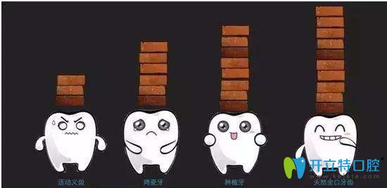 缺牙后的做哪些修復(fù)好