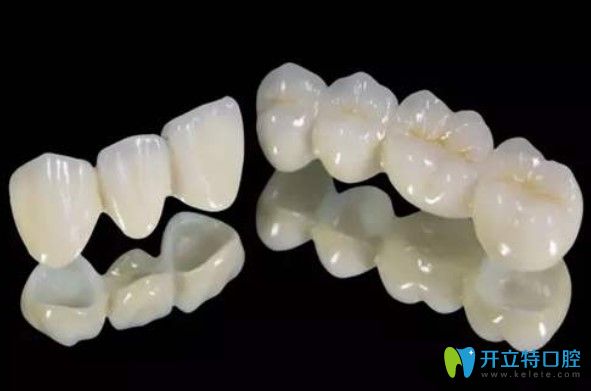 陳醫(yī)生對于牙齒修復(fù)的幾個問題的解答