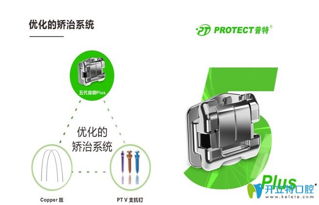 普特自鎖托槽價格是多少