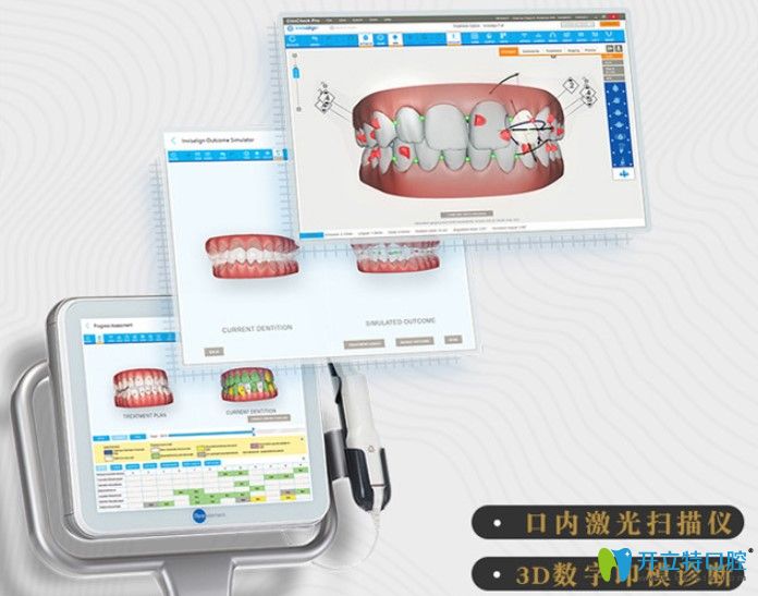 北京壹加壹口腔隱形矯正效果可提前預(yù)知
