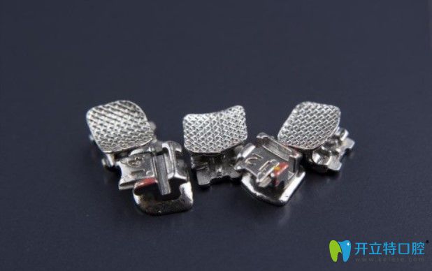 普特三代托槽優(yōu)勢