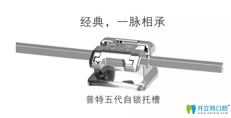 普特三代和五代托槽選哪個