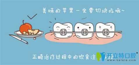 正畸過(guò)程中需注意飲食 正畸過(guò)程中需注意飲食