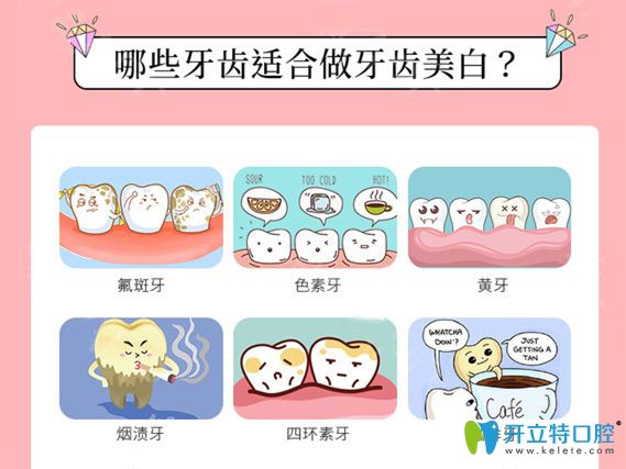 適合做牙齒美白人群介紹 適合做牙齒美白人群介紹