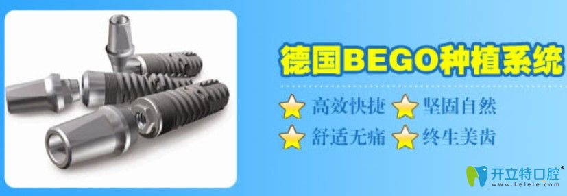 干貨！德國貝格種植牙價格是多少？bego和瑞士iti哪個好