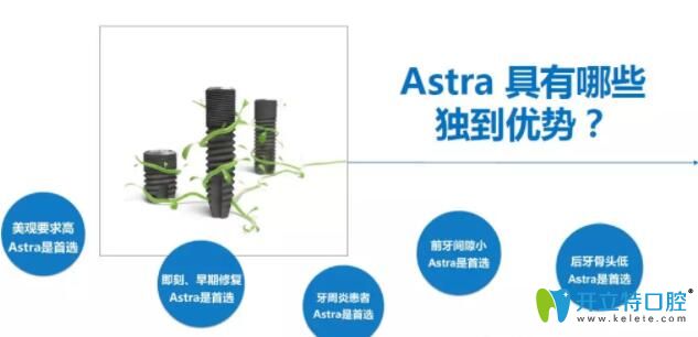 Astra 種植體