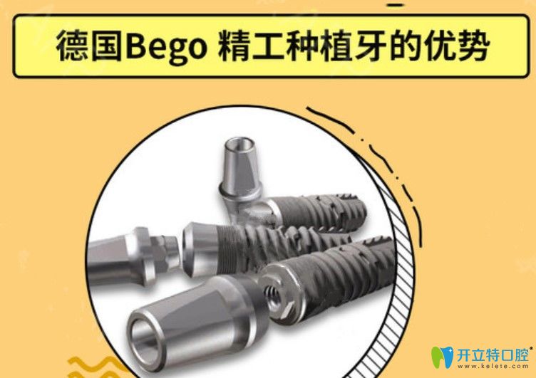 德國bego種植牙優(yōu)勢
