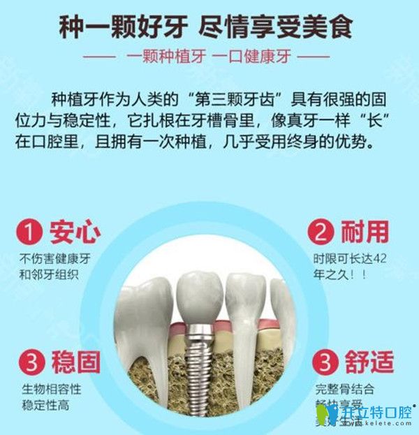 種植牙的優(yōu)勢(shì)