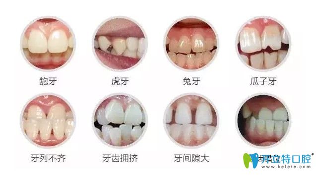 瑞德凌詩青醫(yī)生解析什么情況下需要做牙齒矯正