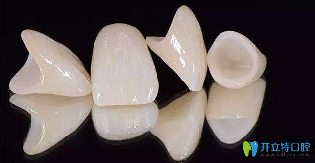 日本則武全瓷牙好嗎？日本全瓷牙和德國(guó)威蘭德全瓷牙區(qū)別