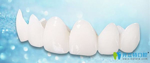 日本則武全瓷牙價格