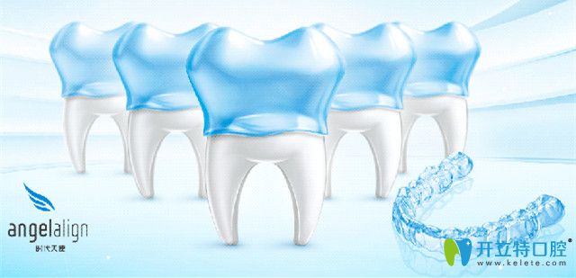 時(shí)代天使隱形矯正優(yōu)惠