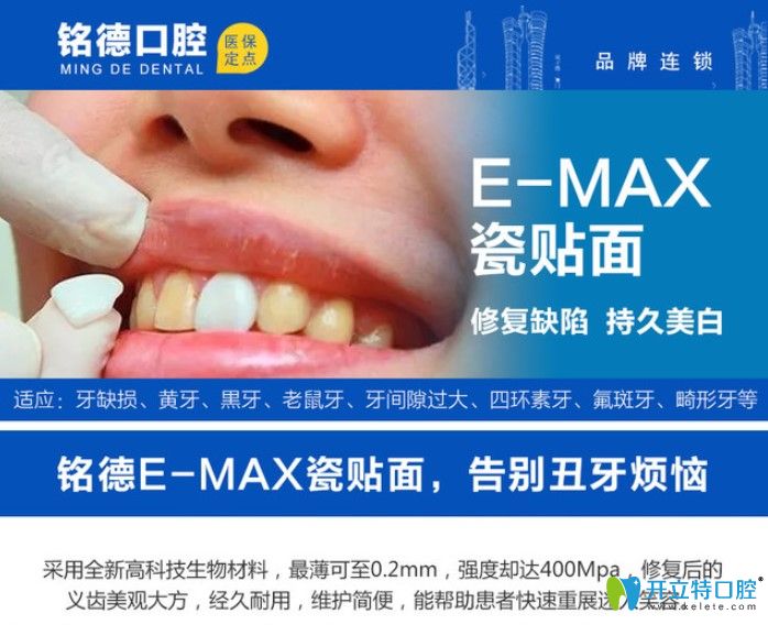 深圳銘德口腔瓷貼面修復(fù)優(yōu)勢