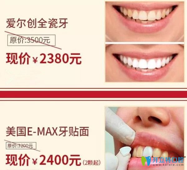 東莞好佰年口腔牙齒貼面活動