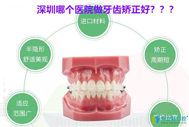 深圳牙齒矯正哪家好?市民反饋美芮口腔正畸價格不高效果好