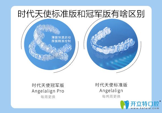 時代天使加強(qiáng)版比標(biāo)準(zhǔn)版貴嗎？看標(biāo)準(zhǔn)版和加強(qiáng)版價格區(qū)別