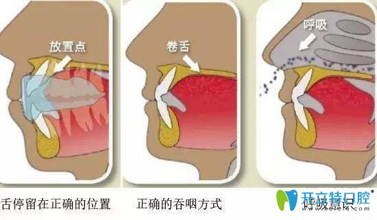 凱思口腔正確的口腔習(xí)慣